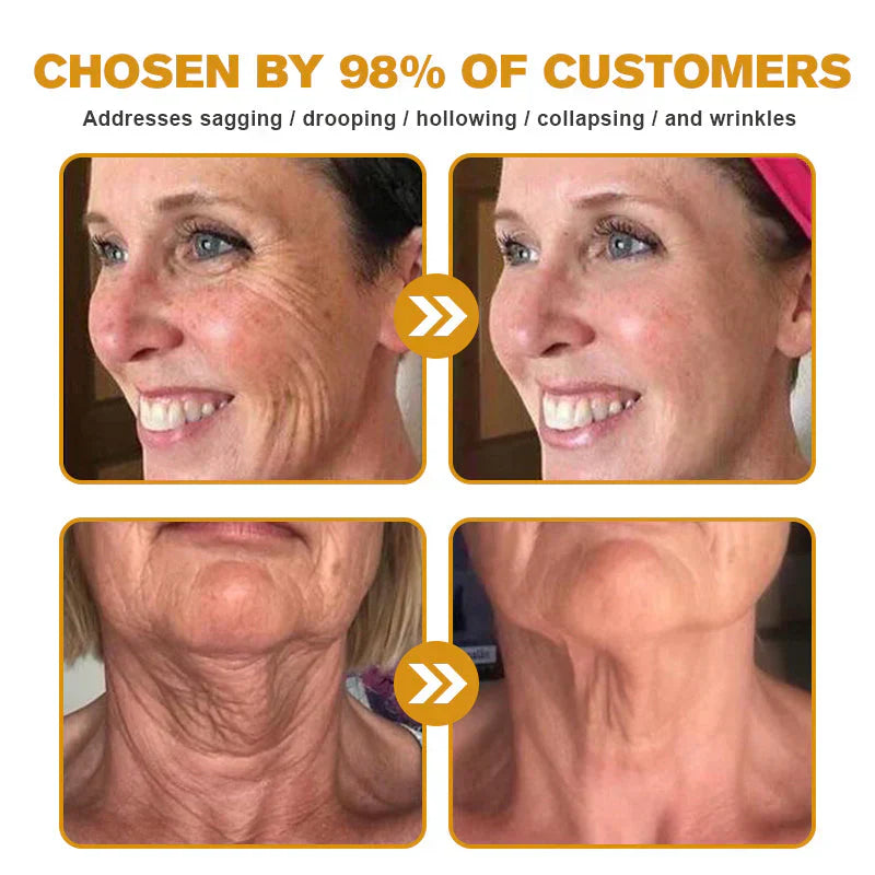 ✨Bee venom facial care ✨Smooth the Look of Wrinkles in 2 minutes — Fast, effective anti-ageing serum — save time and money