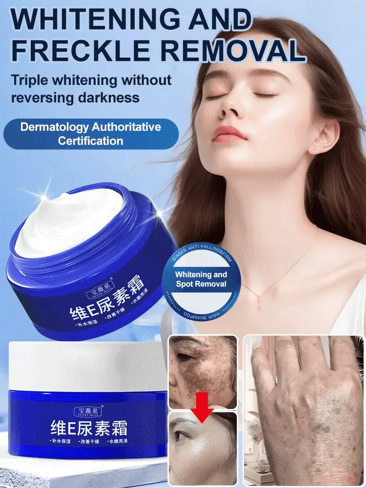 🔥BUY 1 GET 1 FREE 🔥 Spot Fading Urea Cream