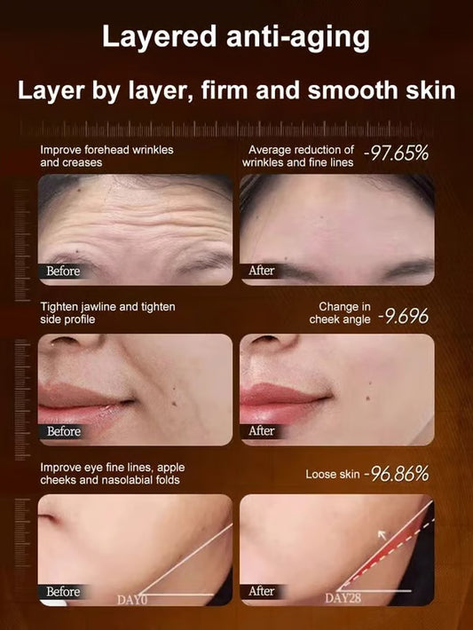 🔥BUY 1 GET 1 FREE🔥【One touch to remove wrinkles】Micro-molecular collagen anti-wrinkle lotion