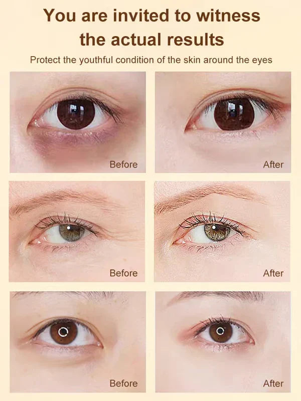 ✨BUY MORE SAVE MORE✨DINKISS LUTEIN EYE ESSENCE OIL