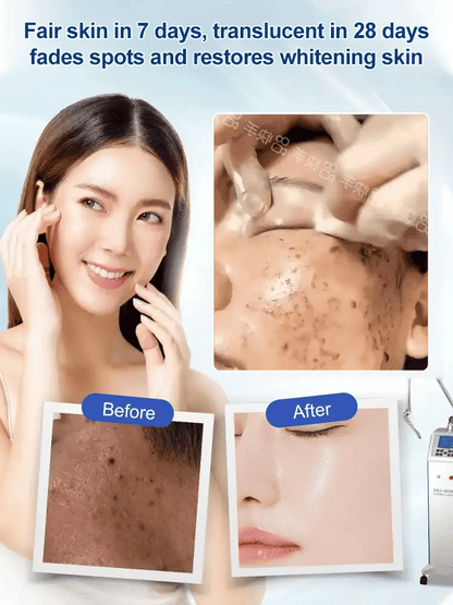🔥BUY 1 GET 1 FREE 🔥 Spot Fading Urea Cream