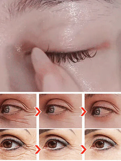 ✨BUY MORE SAVE MORE✨DINKISS LUTEIN EYE ESSENCE OIL