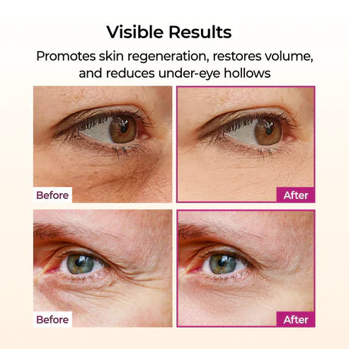 🏆 #1 Bestselling🏆-- Calcium Multi Balm 💫 Anti-Aging & Firming Korean Skincare Stick🔥