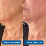 💥Buy more&Save more💥3% Hyaluronic Acid Ultra Hydrating Serum by TurmSkin