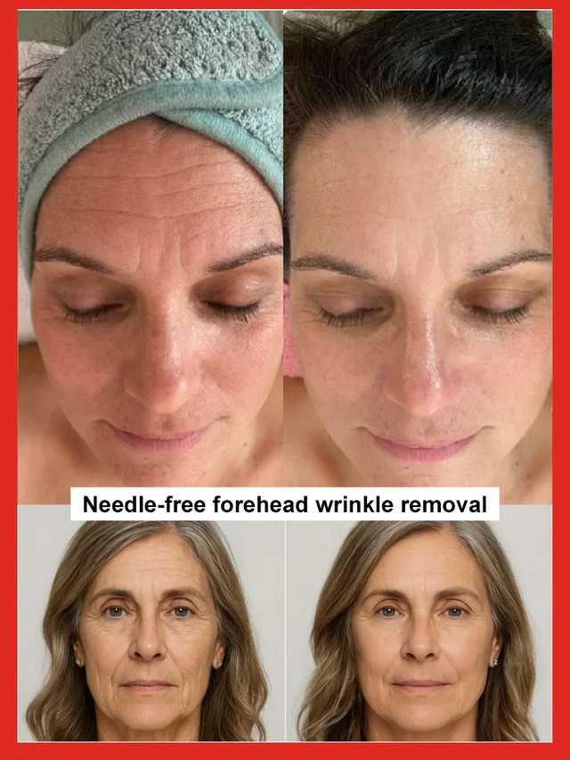 🔥BUY 1 GET 1 FREE🔥🔥Flash Sale⚡ 50K+ SOLD! Salmon Water Light Anti-Wrinkle Essence