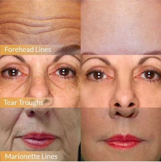 🔥 BUY MORE SAVE MORE🔥POLYPEPTIDE FIRMING FULL FACE CREAM-CHANGE FOR BEAUTIFUL SKIN WITHIN 2 WEEKS