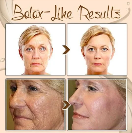 🔥 BUY MORE SAVE MORE🔥POLYPEPTIDE FIRMING FULL FACE CREAM-CHANGE FOR BEAUTIFUL SKIN WITHIN 2 WEEKS
