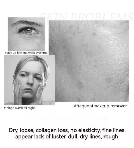 🔥 BUY MORE SAVE MORE🔥POLYPEPTIDE FIRMING FULL FACE CREAM-CHANGE FOR BEAUTIFUL SKIN WITHIN 2 WEEKS