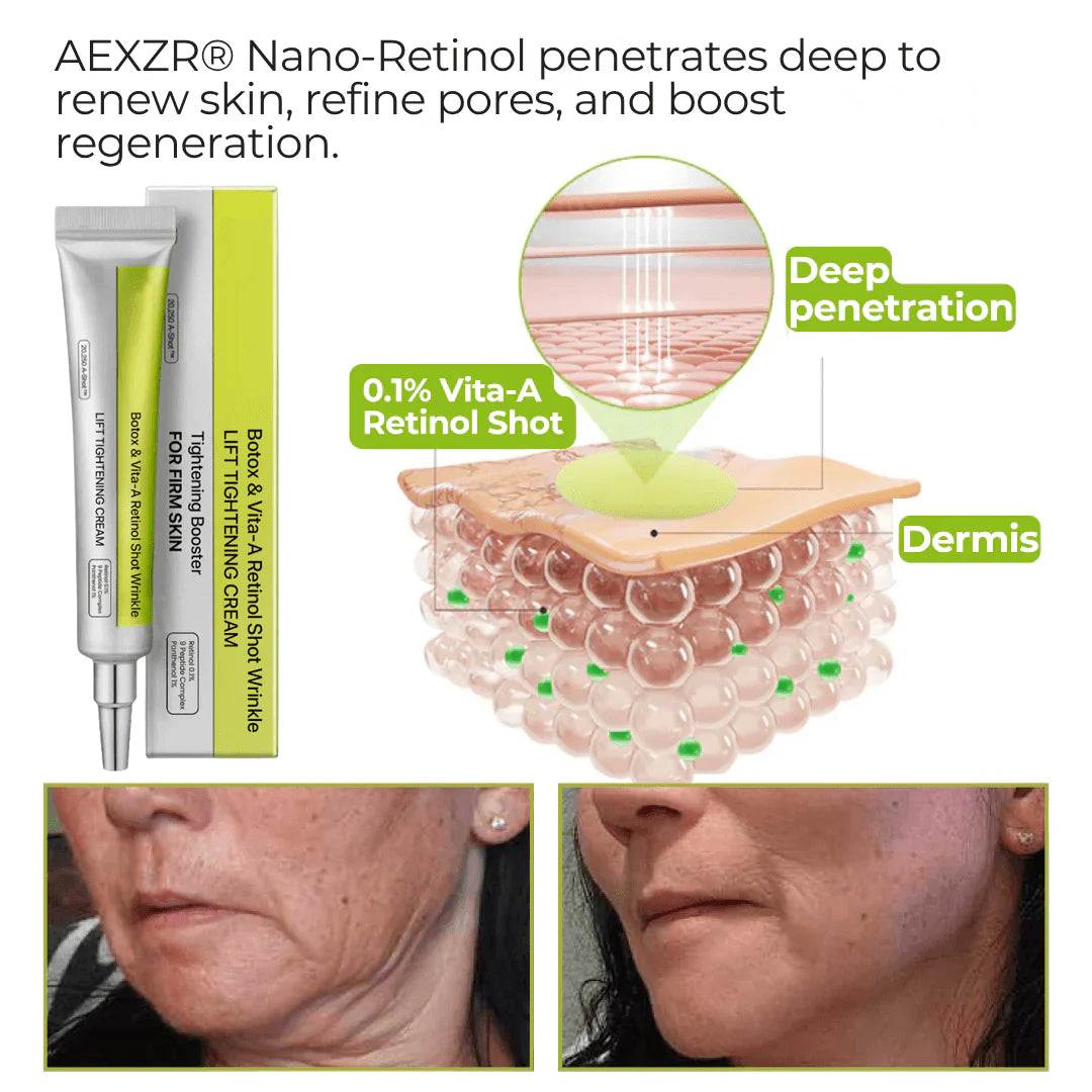⏰ FLASH SALE: 72-Hour Wrinkle Eraser |  Botox & Vita-A Retinol Shot Wrinkle - Lift Tightening Cream
