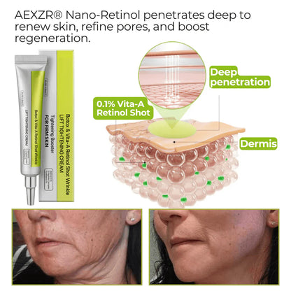 ⏰ FLASH SALE: 72-Hour Wrinkle Eraser |  Botox & Vita-A Retinol Shot Wrinkle - Lift Tightening Cream
